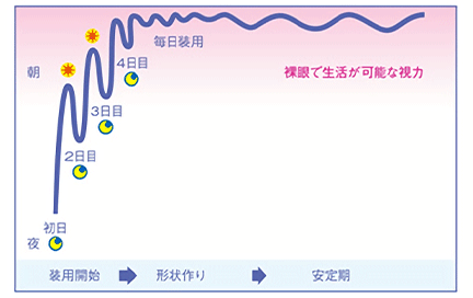 安定した視力が得られるまでのイメージ