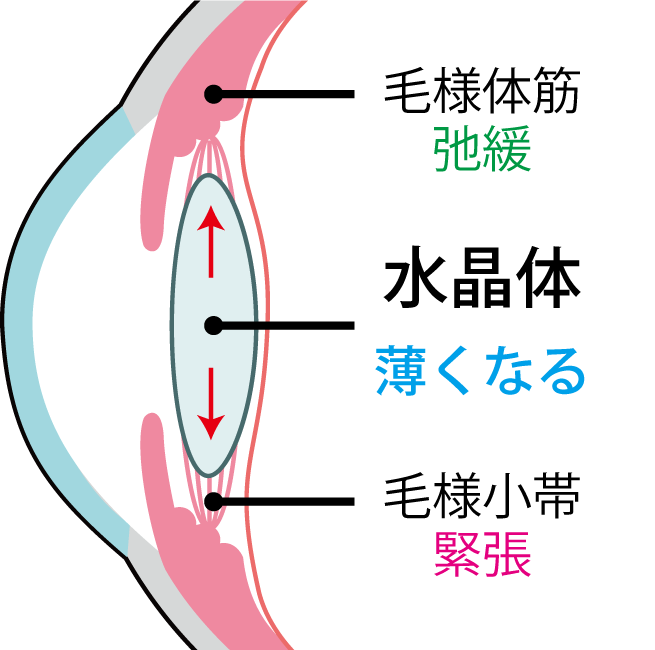 毛様体筋が弛緩し、毛様小帯が緊張すると、水晶体が薄くなる