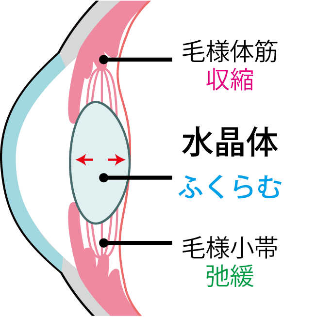 毛様体筋が収縮し、毛様小帯が弛緩すると、水晶体がふくらむ