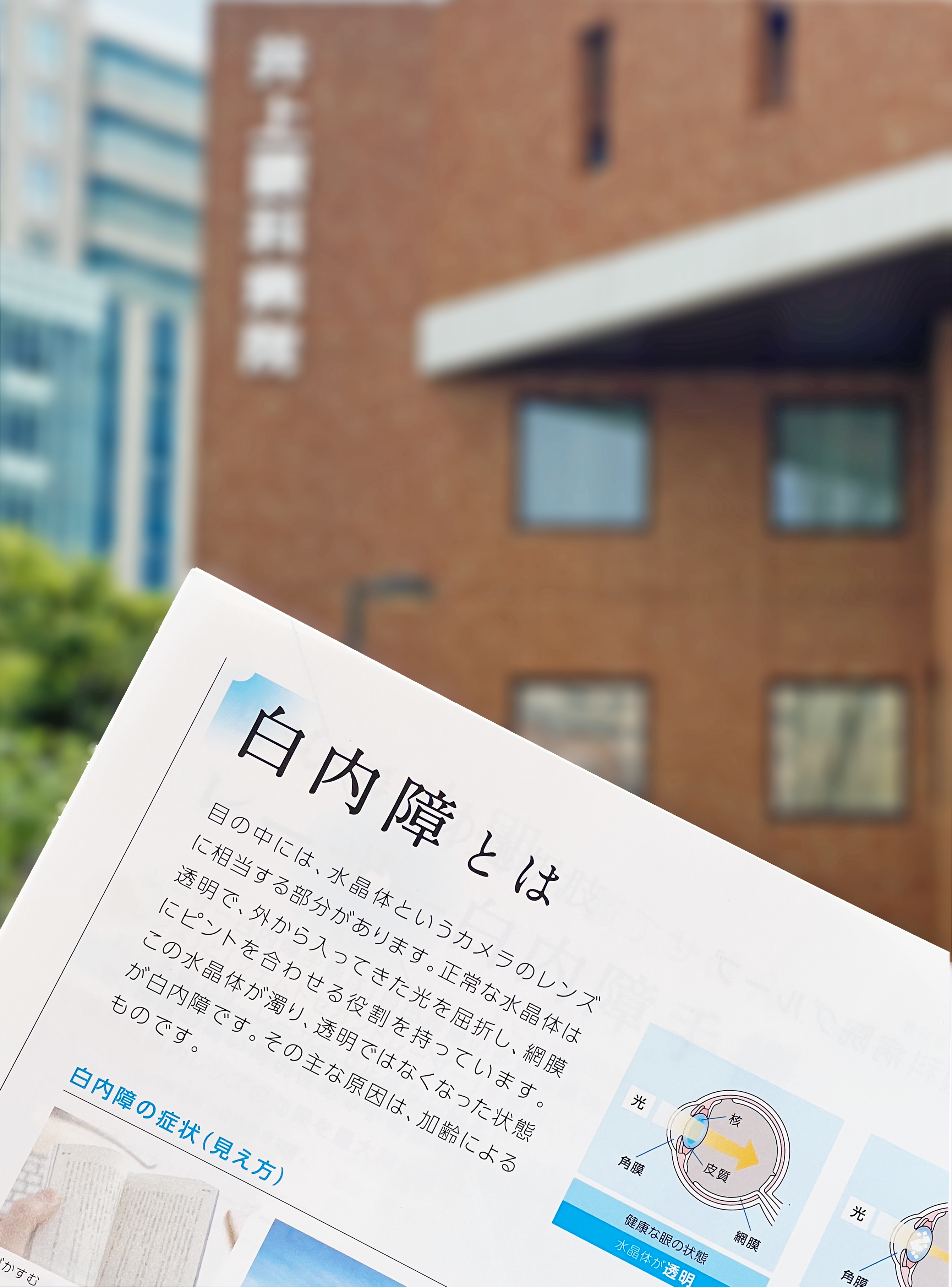 「遠く」がぼやける→遠くを見るメガネが必要に